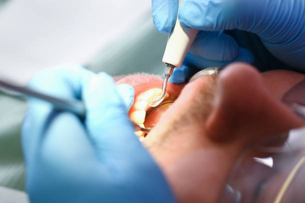 Best Emergency Dental Care for Abscessed Tooth in Balfour, NC