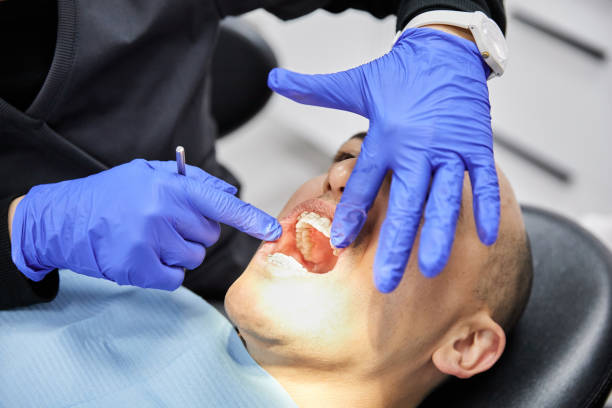 Best Emergency Root Canal Treatment in Balfour, NC